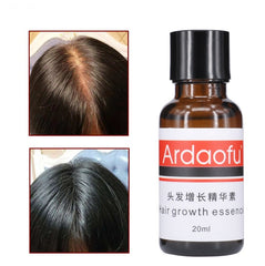 Growth, hair loss, hair growth prevention